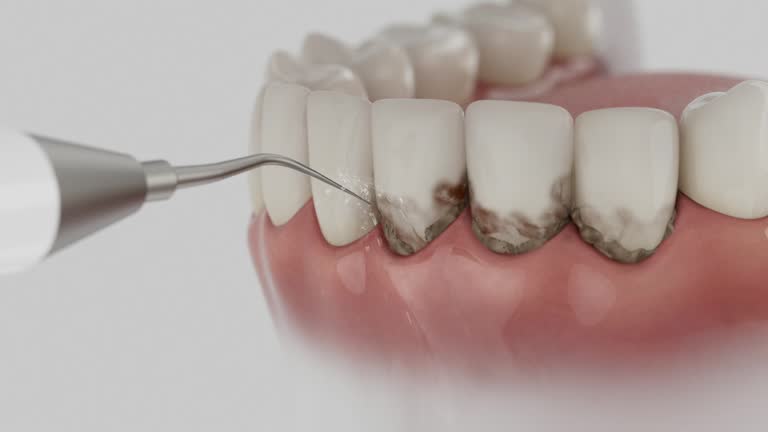Reliable Dental contractor in Palmyra, MO by Dentist Open Now